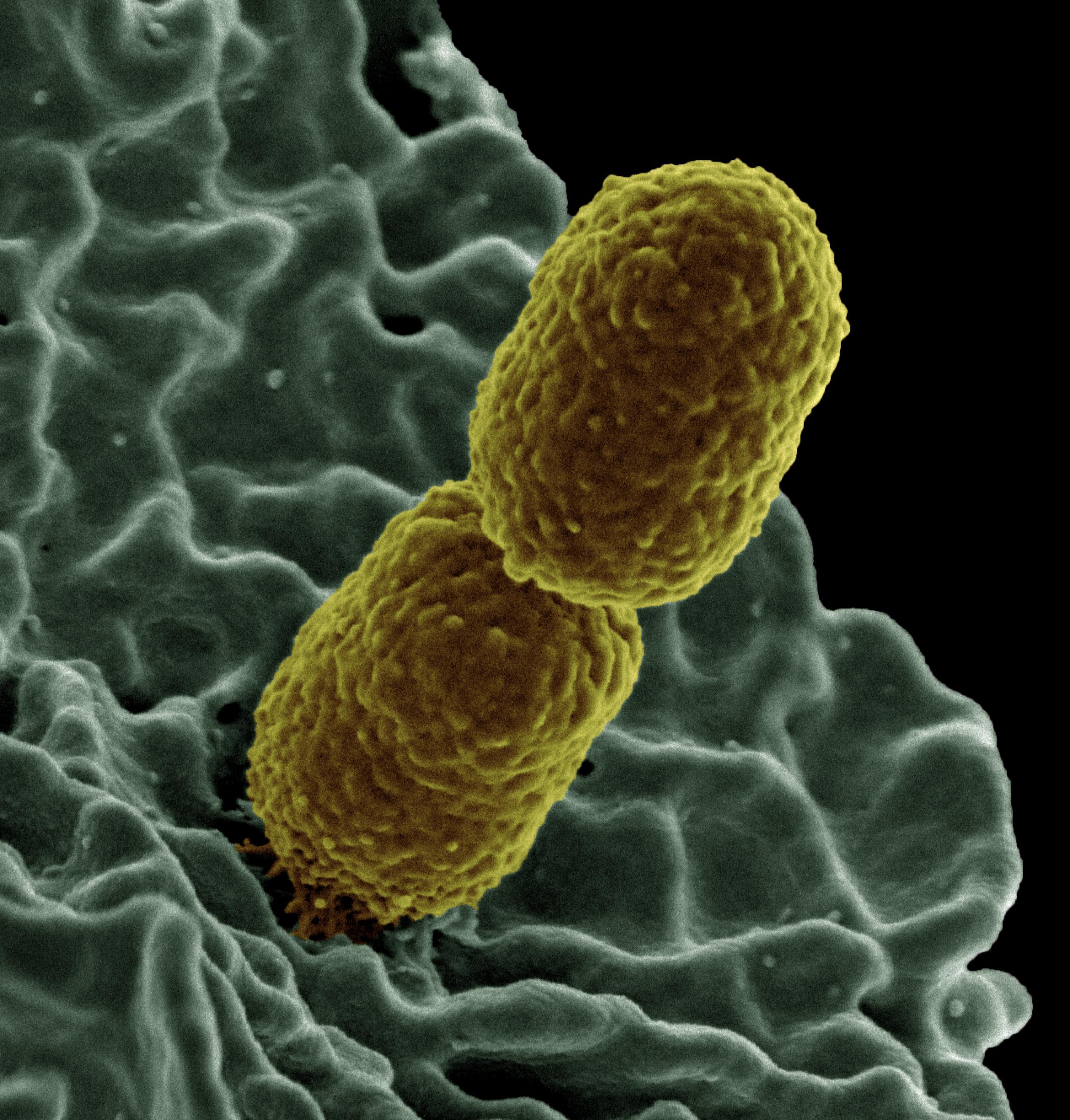 Klebsiella pneumoniae organism