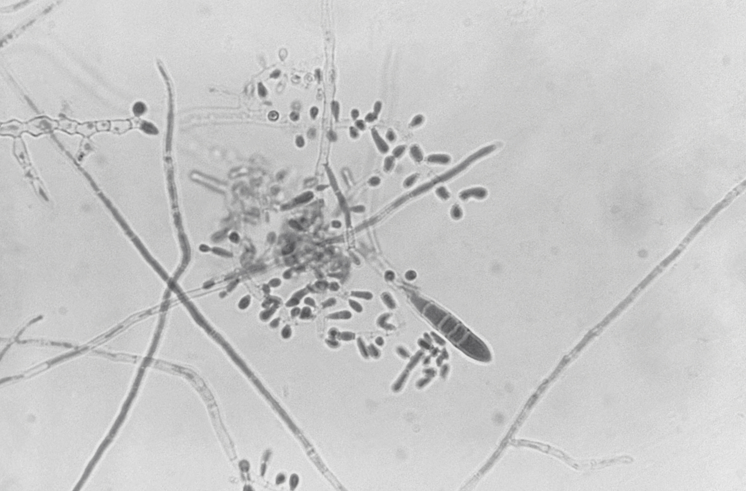 Dermatophyte organism