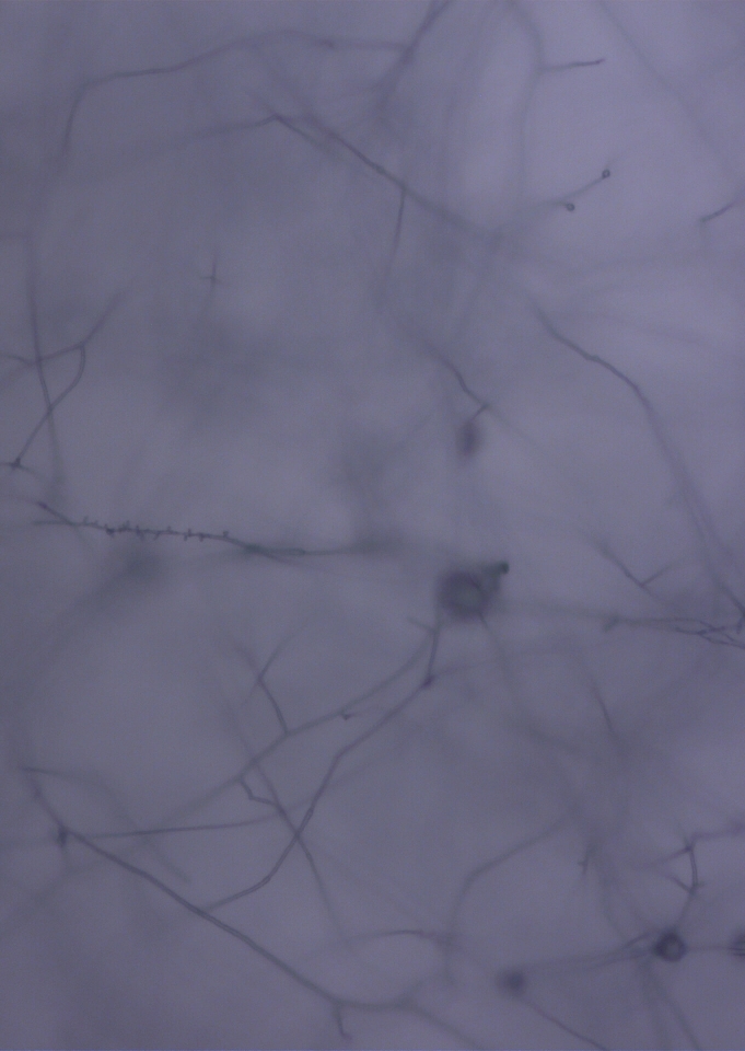 Dermatophyte organism